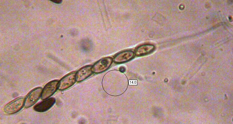 Asci of Daldinia concentrica
