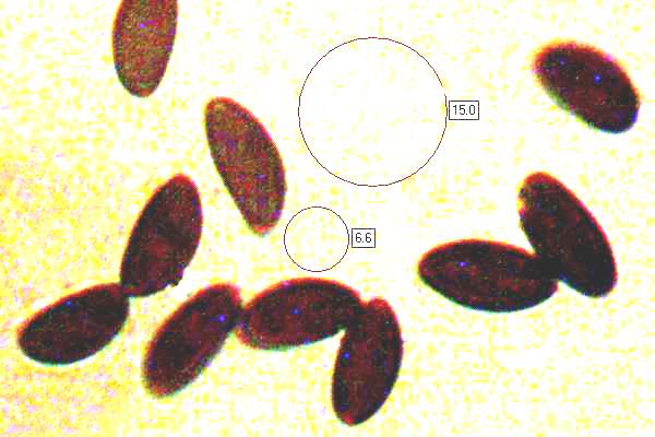 Spores of Daldinia concentrica