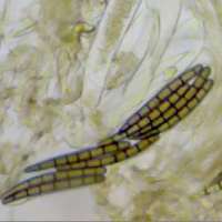 Asci of Geoglossum cookeanum
