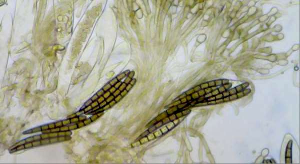 Asci of Geoglossum cookeanum