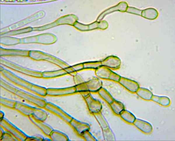 Paraphyses of Geoglossum cookeanum