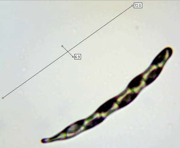 Spores of Geoglossum cookeanum