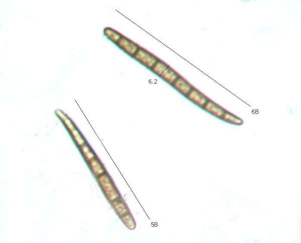 Mature spores of Geoglossum cookeanun