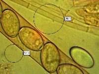 Spores of Geopopra arenosa