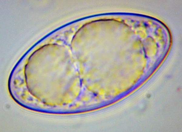Spores of Geopora sumneriana