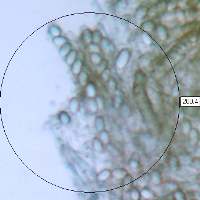 Asci of Helvella elastica