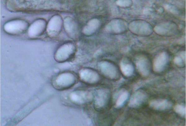 Asci of Helvella elastica