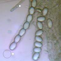 Asci of Helvella lacunosa