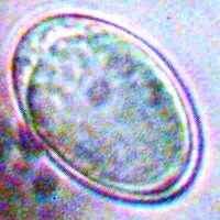 Ascospore of Brittle Cinder fungus