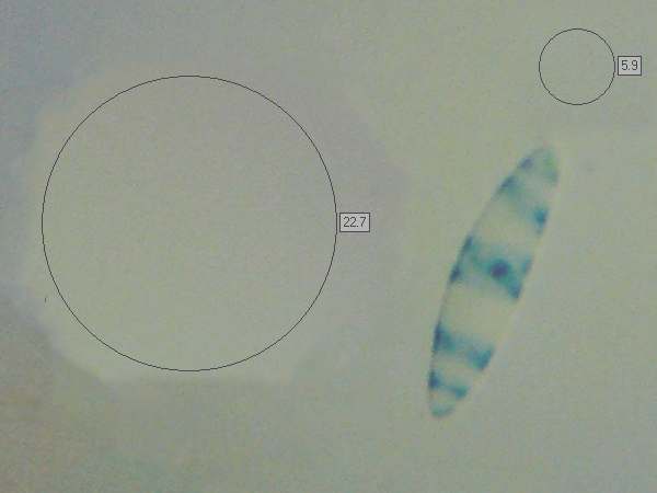 Spores of Leotia lubrica