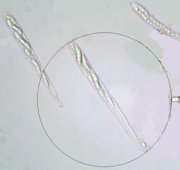 Asci of Microglossum pratense