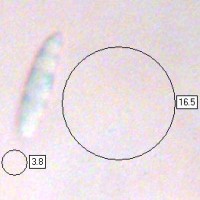 Spores of Microglossum pratense