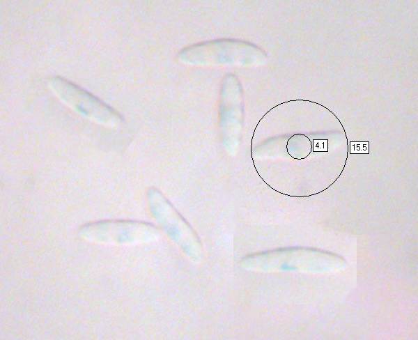 Spores of Microglossum pratense