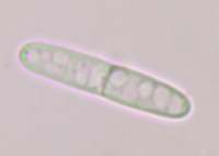 Spore of Mitrula paludosa, Bog Beacon