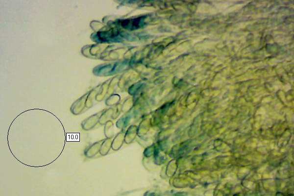 Asci of Otidea bufonia