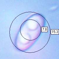 Spore of Otidea bufonia