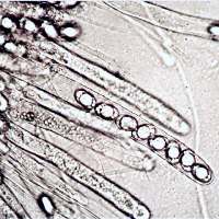Asci of Otidea onotica