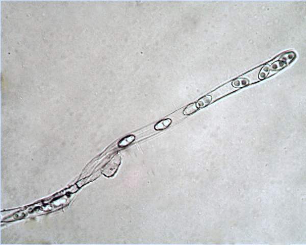 Asci of Otidea onotica