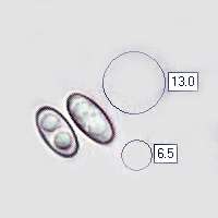 Spores of Itidea onotica