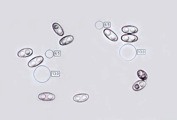 Spores of Otidea onotica