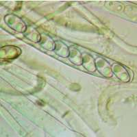 Asci of Peziza badia