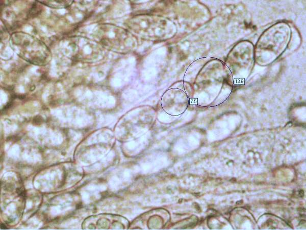 Asci of Peziza violacea