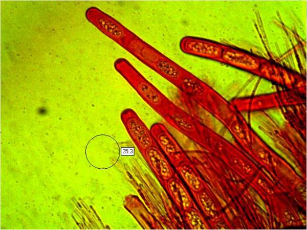 Asci of Sarcoscypha austriaca