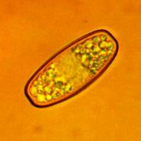 Spores of Sarcoscypha austriaca, Scarlet Elfcup