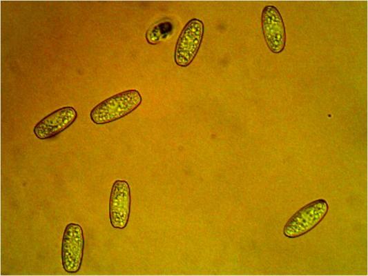 Spores of Sarcoscypha austriaca