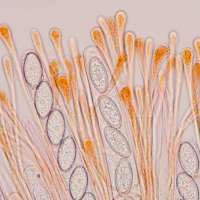 Spores of the Eyelash Fungus, Scutellaria scutellata