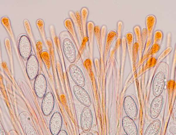 Asci of Scutellinia mirabilis