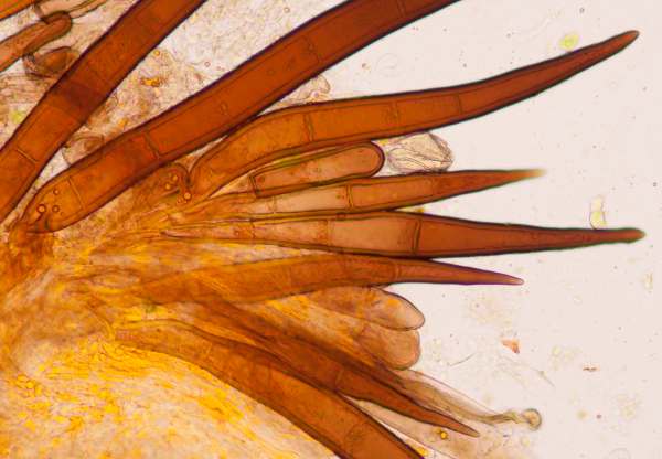 Hairs of Scutellinia mirabilis