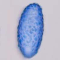 spores of Scutellinia mirabilis