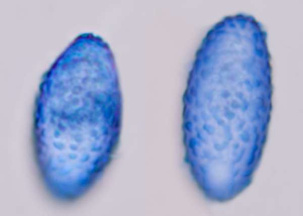 Spores of Scutellinia mirabilis