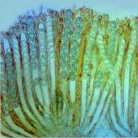 A mature ascus of Scutellinia scutellata with its eight spores