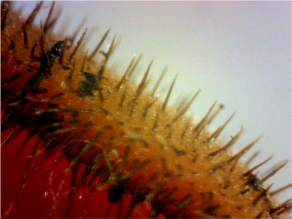 Hairs of Scutellinia scutellata