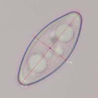 Spores of Thelebolus terrestris