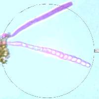 Asci and spores of Trichoderma viride