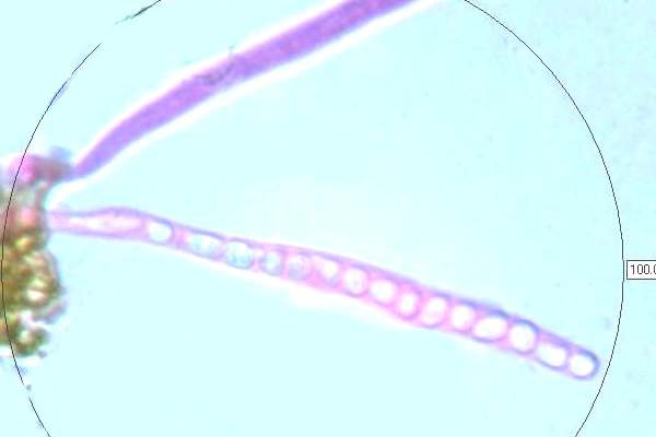 Asci of Trichoderma viride