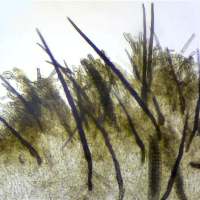 Setae  of Trichoglossum hirsutum