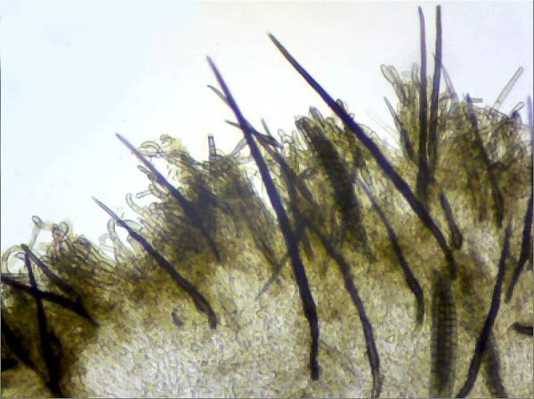 Setae of Trichoglossum hirsutum