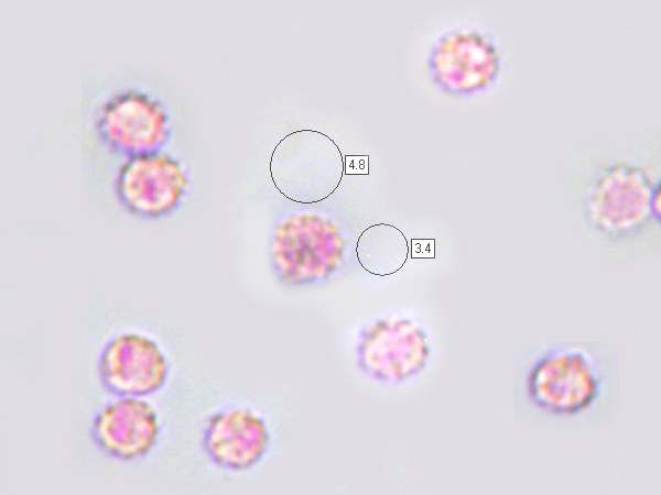 Spores of Phellodon niger