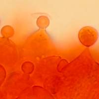 Cheilosidia of <em>Conocybe tenera</em>