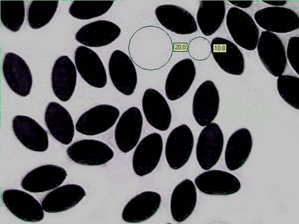 Spores of Panaeolus papilionaceus