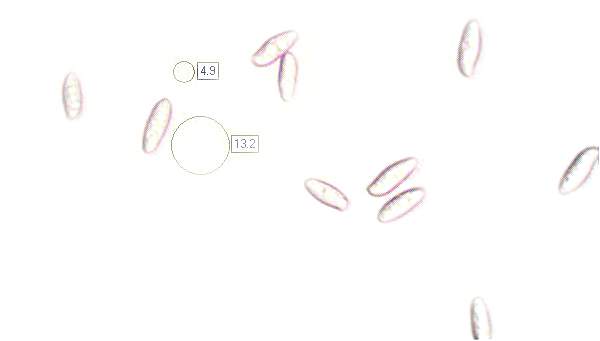 Spores of Boletus aereus