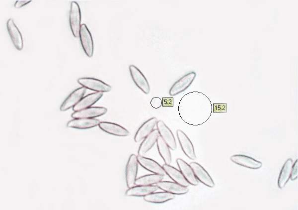 Spores of Boletus edulis