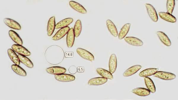 Spores of Boletus subtomentosus