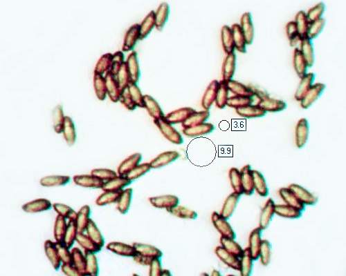 Spores of Chalciporus piperatus