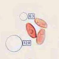 Spores of Hemileccinum impolitum