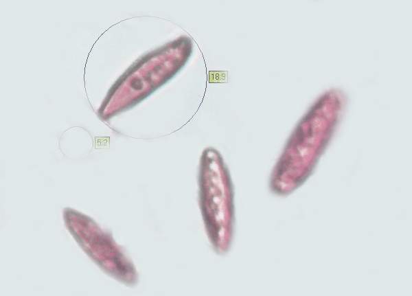 Spores of Leccinum cyaneobasileucum